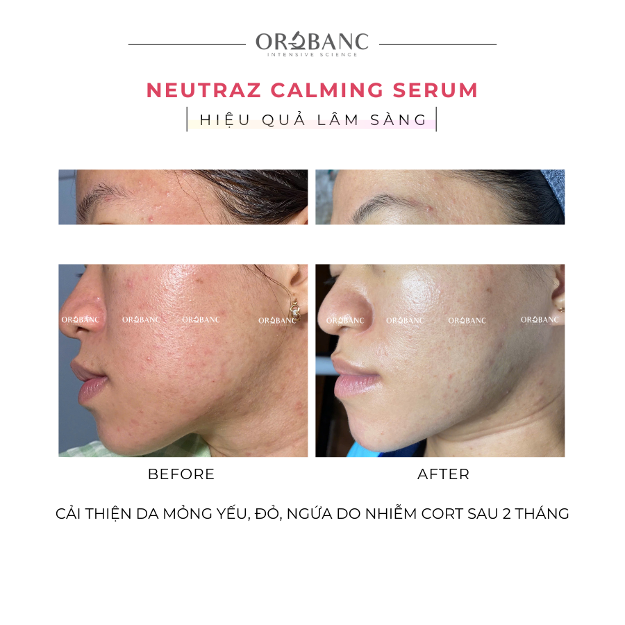 web_TotalStrengthSerum_10ml_1200x1200